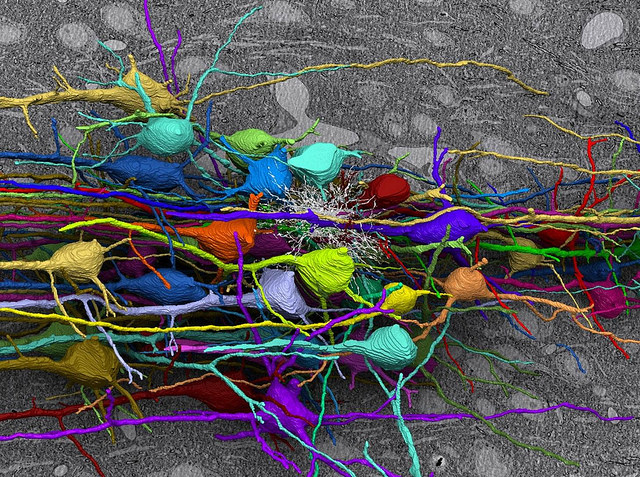 Mouse Brain Expanded with Human DNA