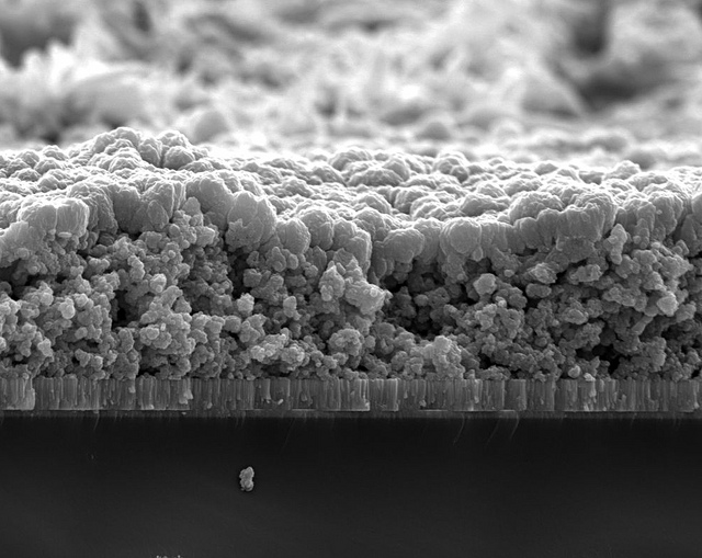 Nanoparticle Dentistry