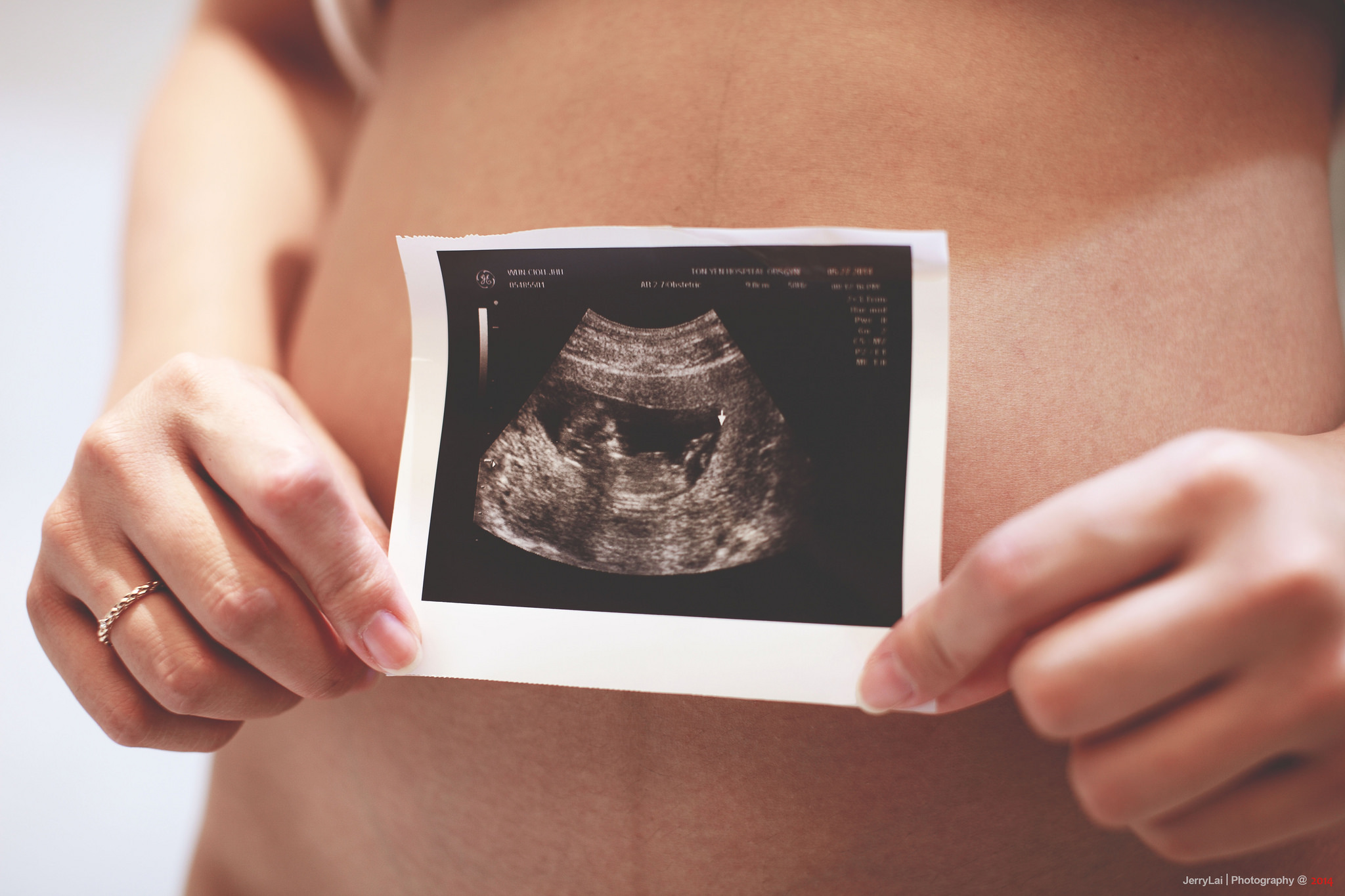 Non-Invasive Prenatal Fetal Testing Could Detect Maternal Cancer