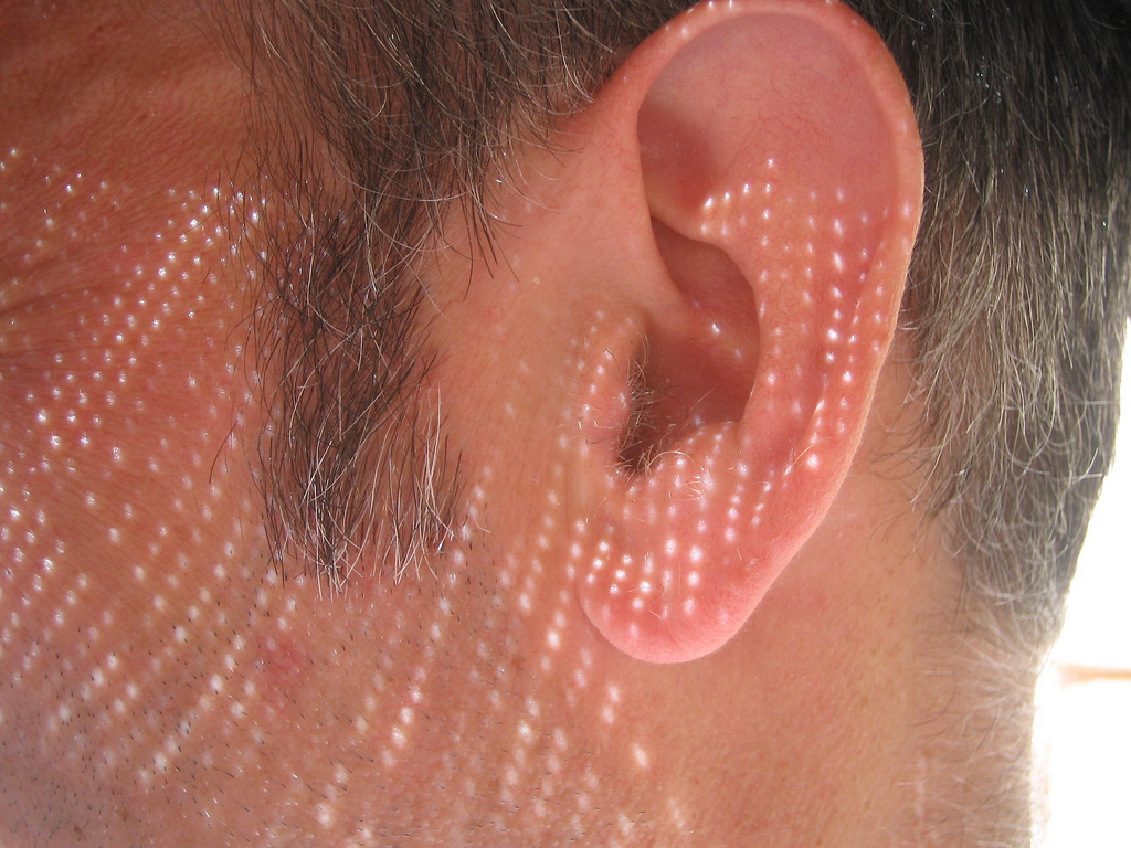 Scientists Discover “Hidden Hearing Loss”