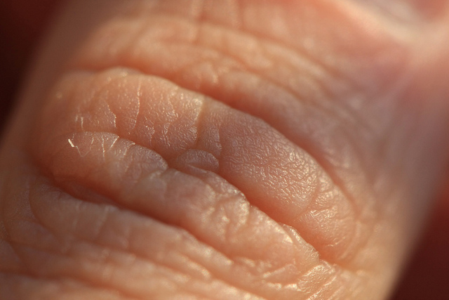 Skin Deep: A New Way to Track Health