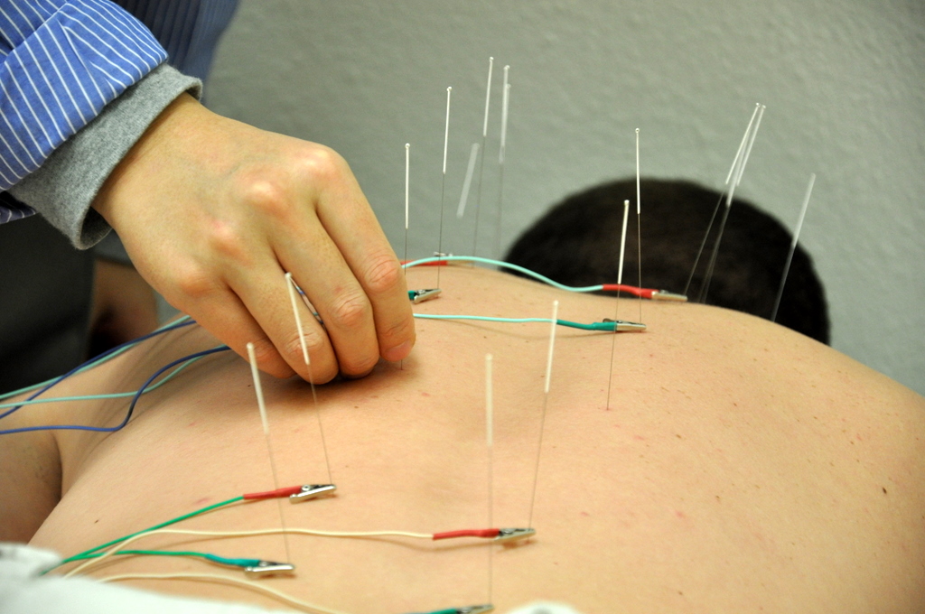 A New Theory for Acupuncture Effectiveness
