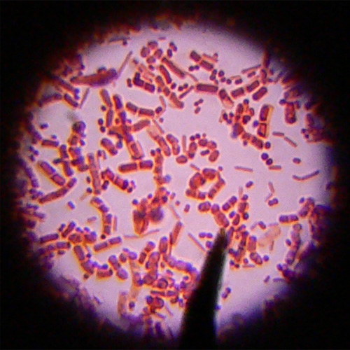 Clostridium Difficile: Superbug of the Century