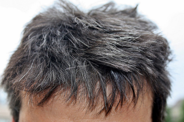 Scientists Find Greying Hair Cells