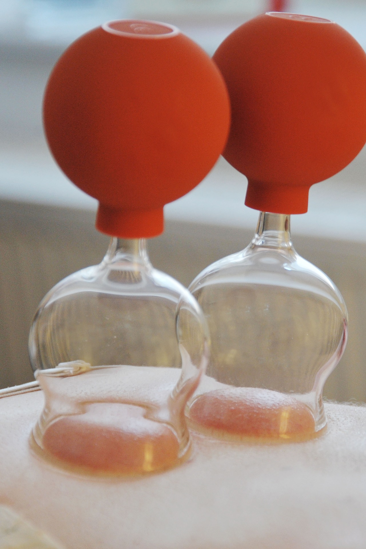 Cupping Therapy: A Sham or Not?