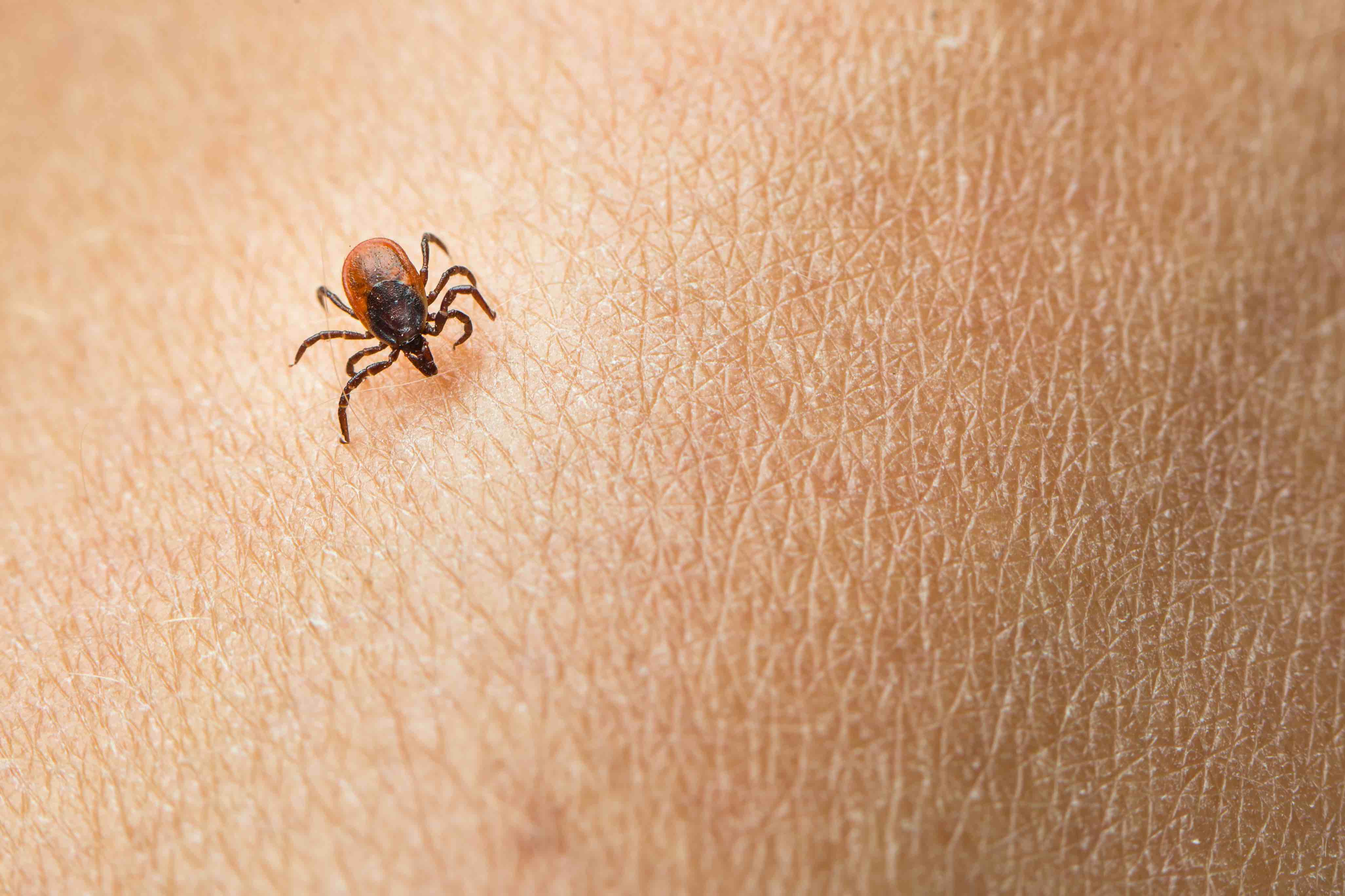 Lyme Disease: A Bigger Threat than Ever Before