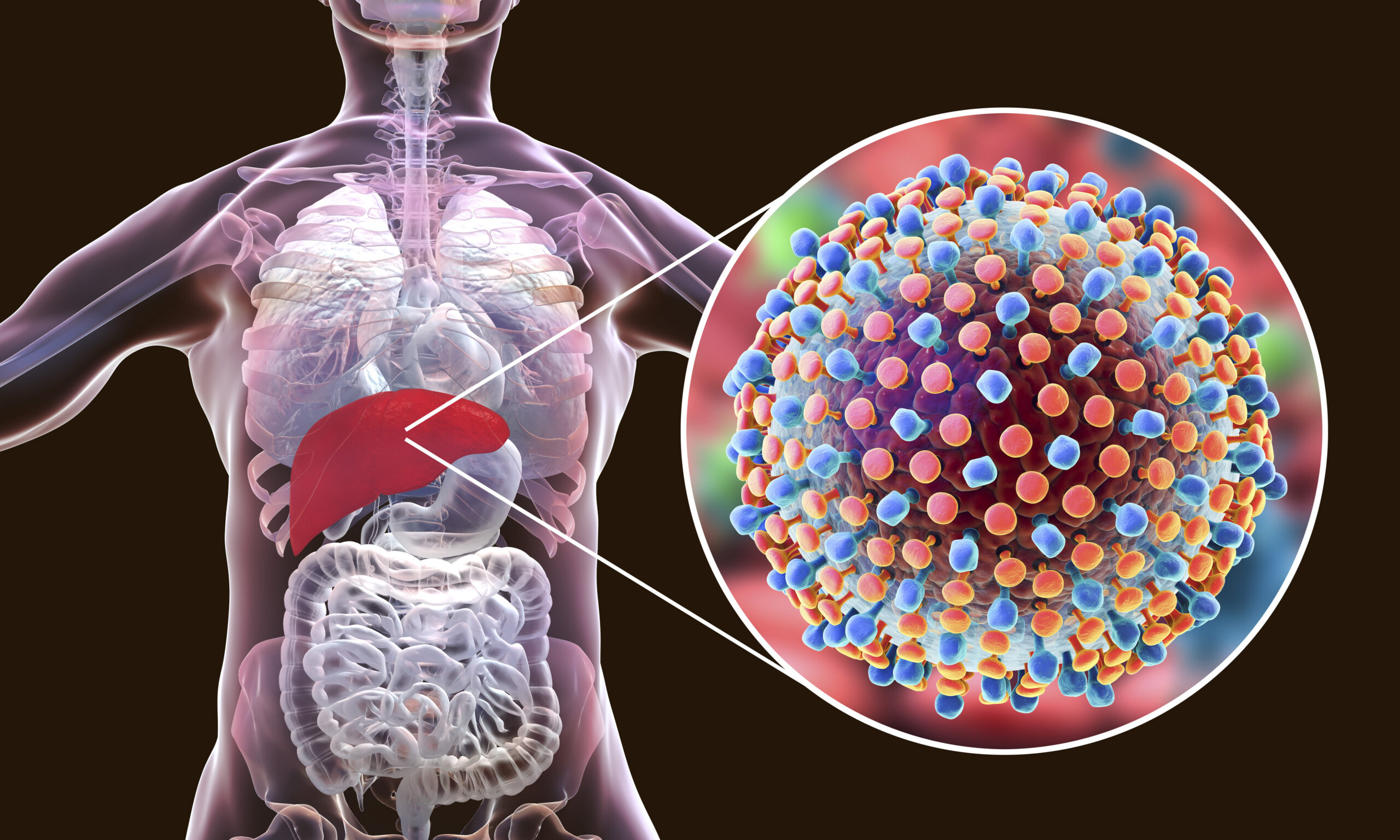 What You Should Know about Hepatitis C