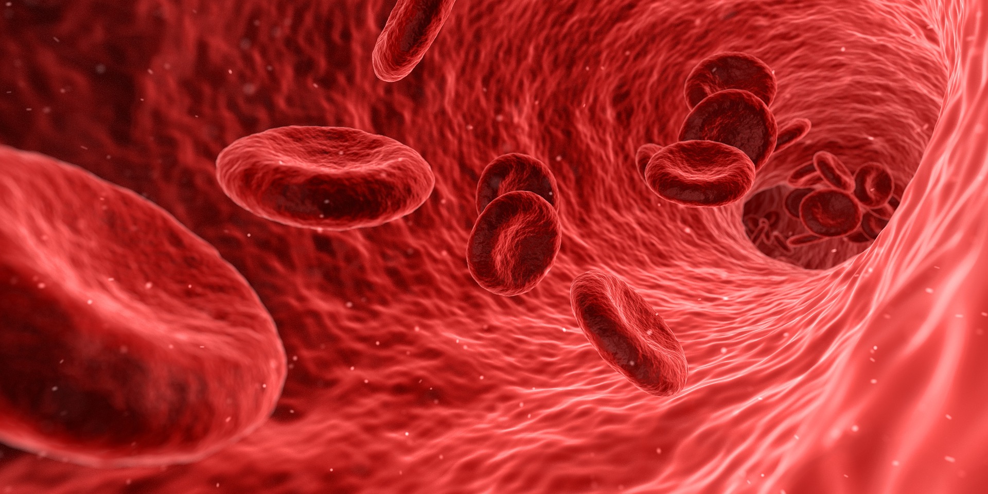 Cell Therapy to Treat Sickle Cell Disease
