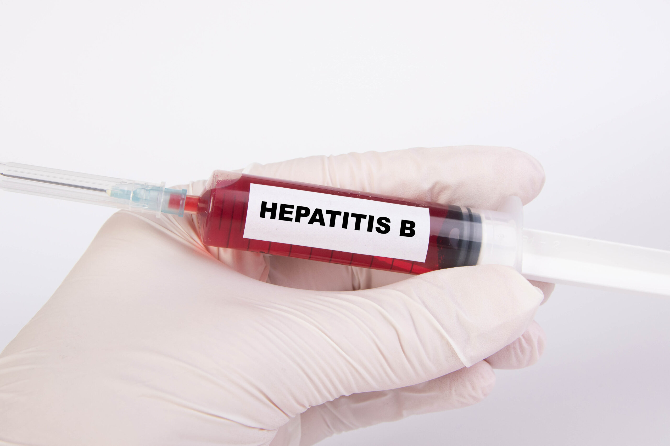 Potential Triple Combination Therapy Method for Hepatitis B Virus