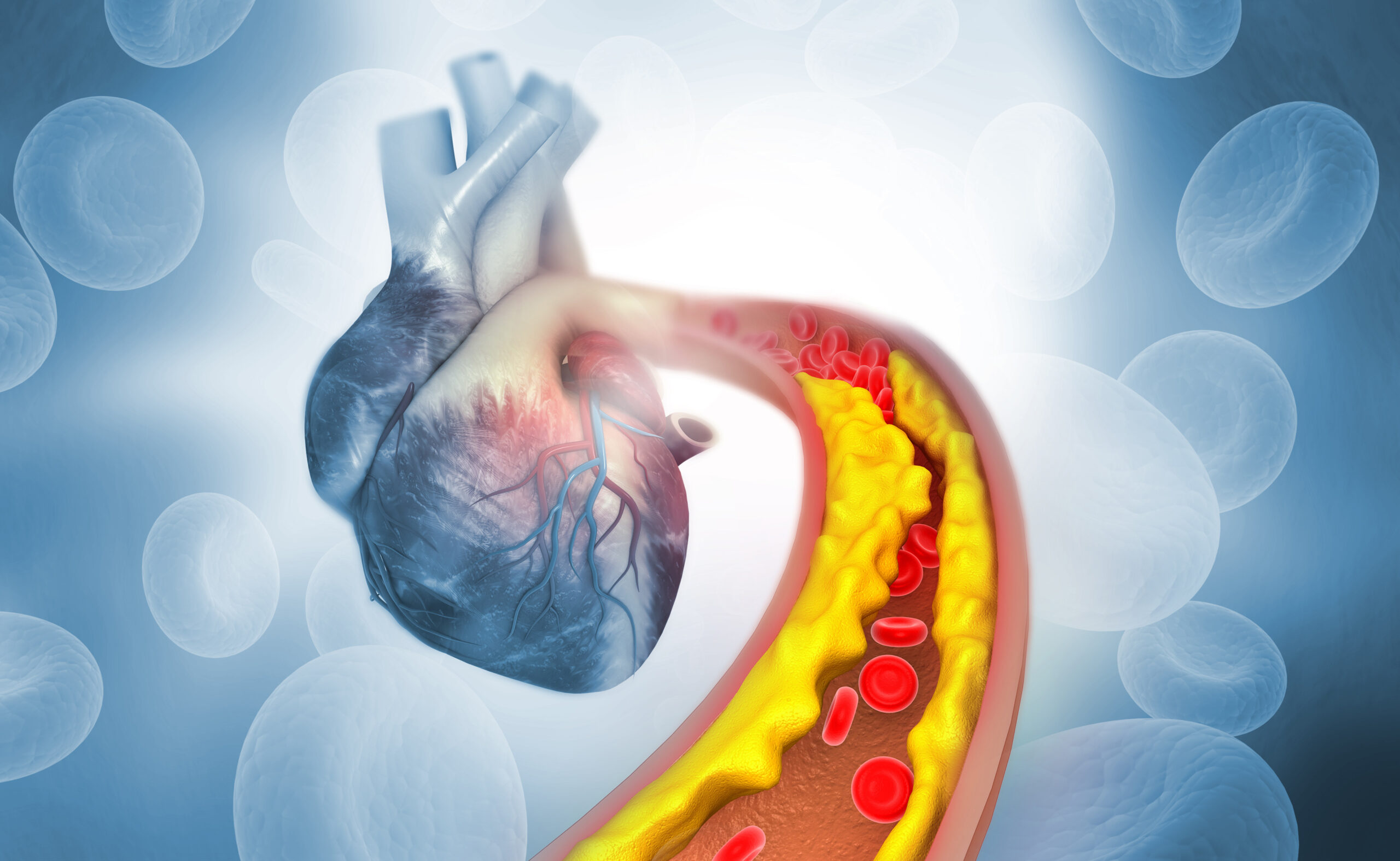 Breaking Down Plaque and Clearing Arteries: New Mechanism Found