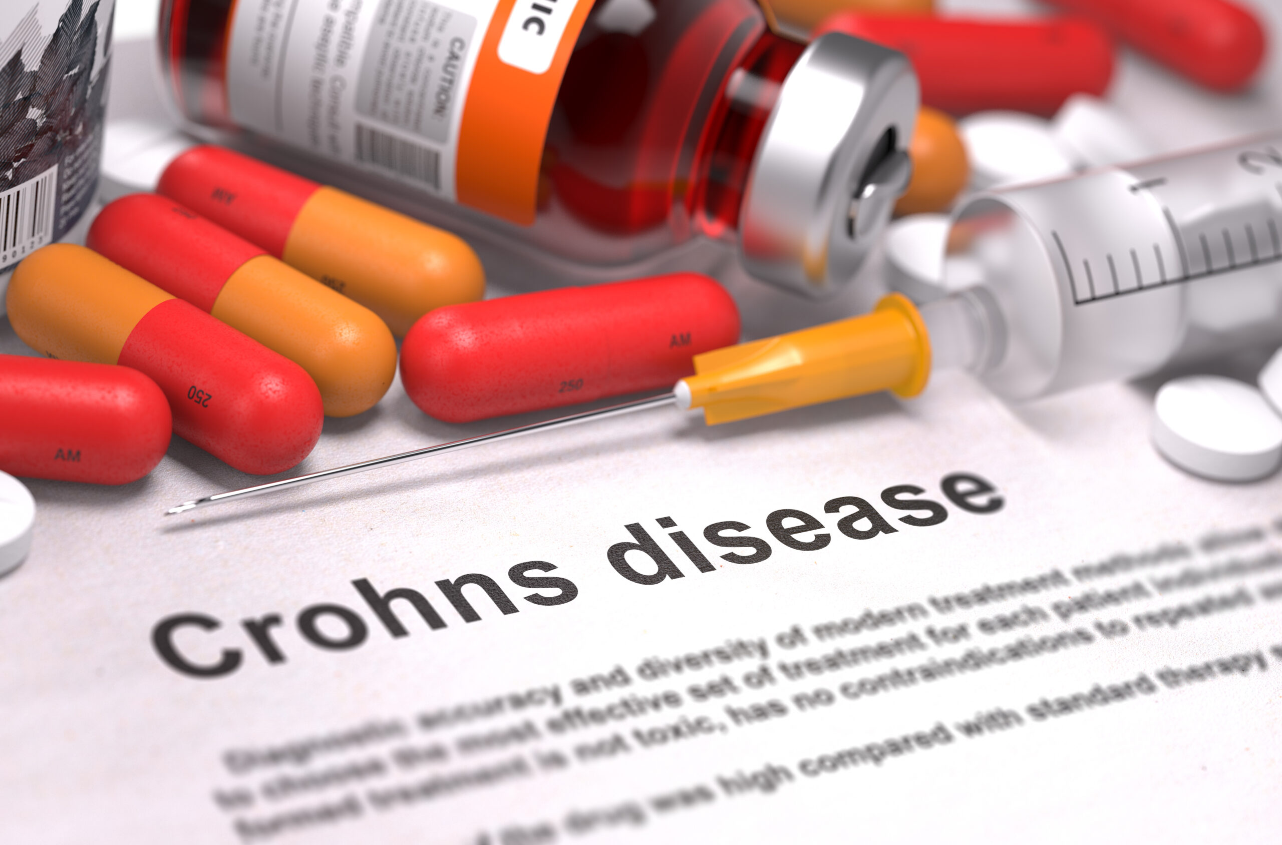 Optimizing Treatment Courses for Crohn’s Disease