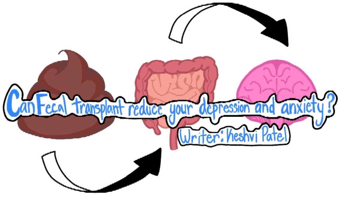 [UCSD Winning Article] Can a Fecal Transplant Reduce Your Depression and Anxiety?