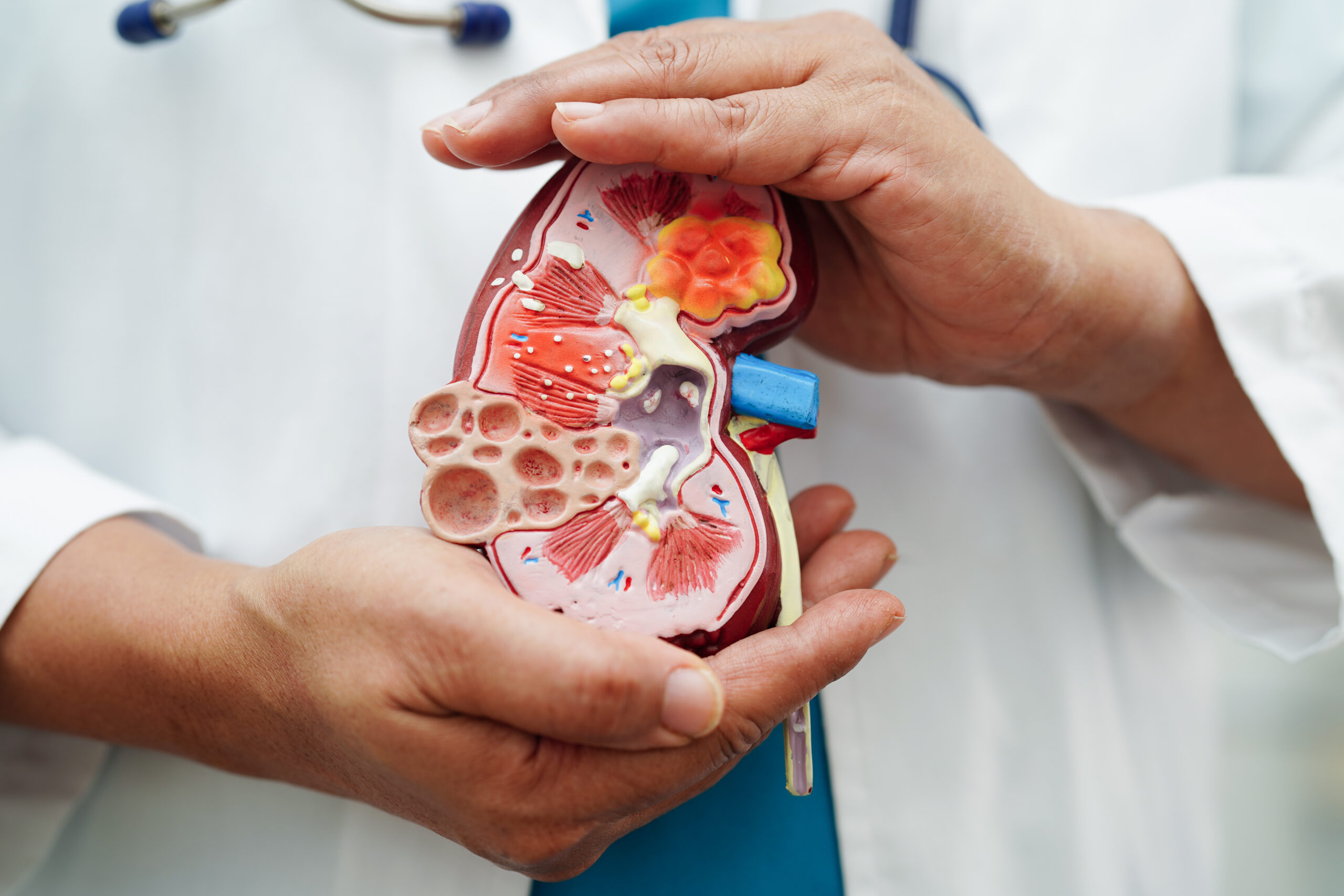The New and Improved Approach to Post-Transplant Medications for Kidney Transplant Patients